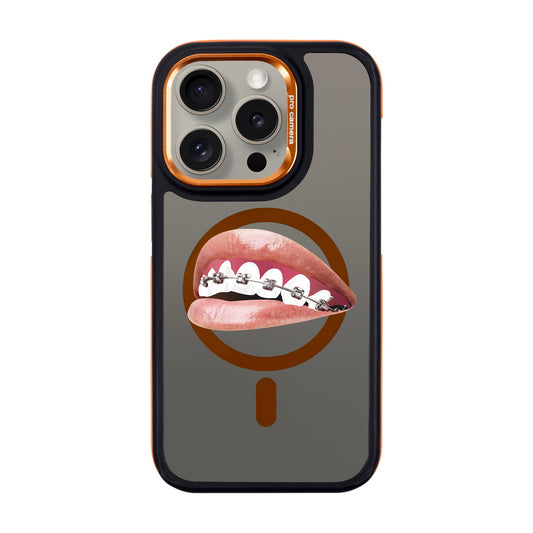 ORTHODONTIST-iPhone 15 Pro Dark Kılıf MagSafe Özellikli