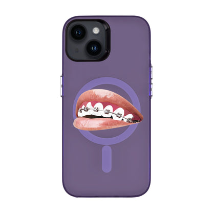 ORTHODONTIST-iPhone 14 Hold Kılıf MagSafe Özellikli