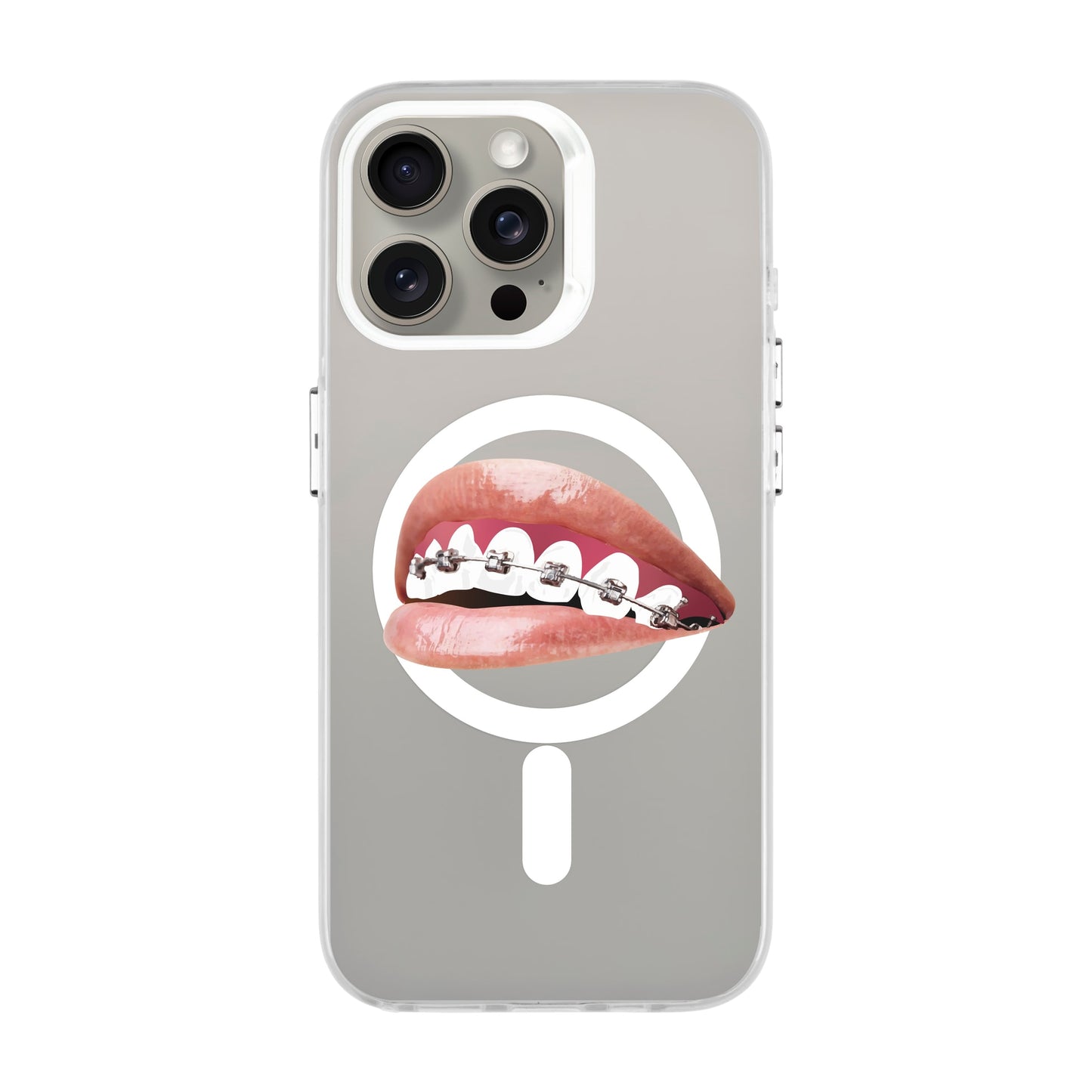 ORTHODONTIST-iPhone 15 Pro Max Hold Kılıf MagSafe Özellikli