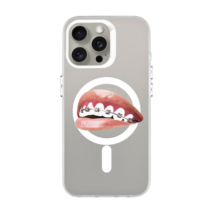 ORTHODONTIST-iPhone 15 Pro Max Hold Kılıf MagSafe Özellikli