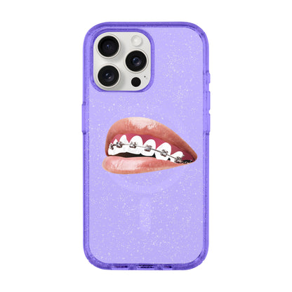 ORTHODONTIST-iPhone 15 Pro Max Shiny Kılıf MagSafe Özellikli