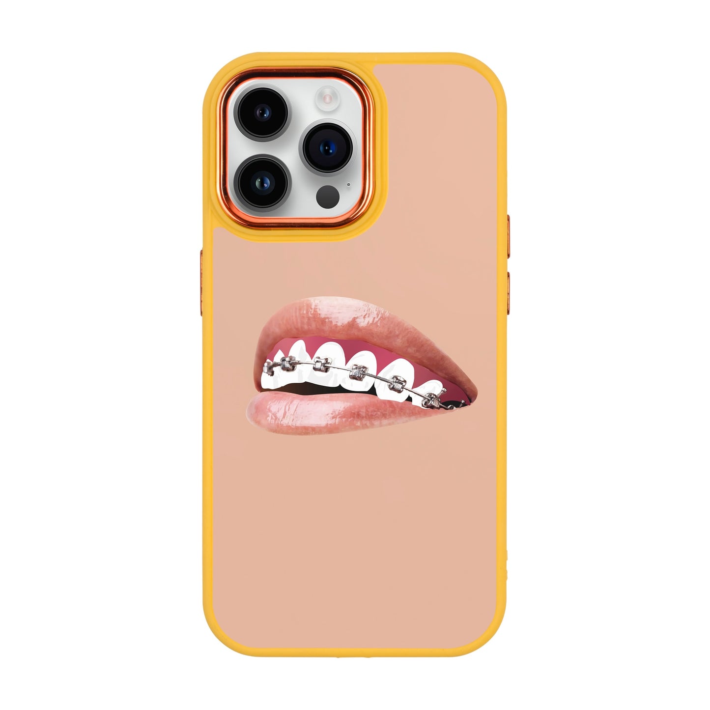 ORTHODONTIST-iPhone 14 Pro Max Proof Kılıf