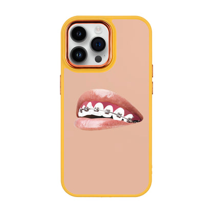 ORTHODONTIST-iPhone 14 Pro Max Proof Kılıf