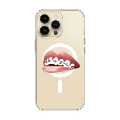 ORTHODONTIST-iPhone 14 Pro Max Solid Kılıf MagSafe Özellikli