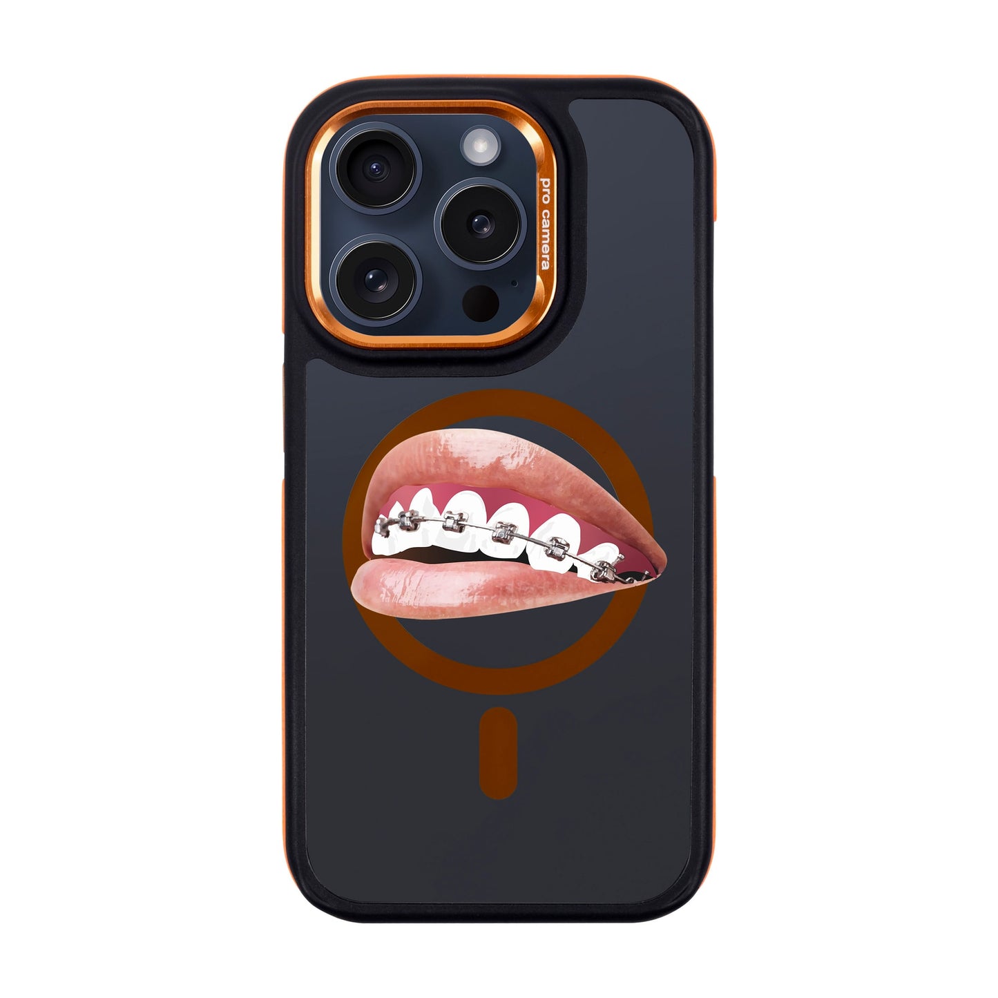 ORTHODONTIST-iPhone 15 Pro Dark Kılıf MagSafe Özellikli