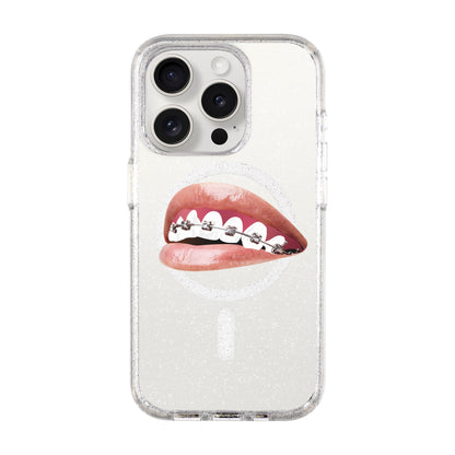 ORTHODONTIST-iPhone 15 Pro Shiny Kılıf MagSafe Özellikli