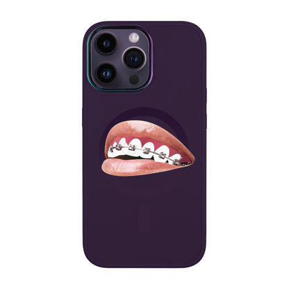 ORTHODONTİST-iPhone 14 Pro Max Vigor Kılıf MagSafe Özellikli