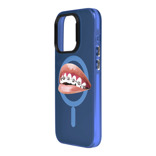 ORTHODONTIST-iPhone 15 Pro Hold Kılıf MagSafe Özellikli
