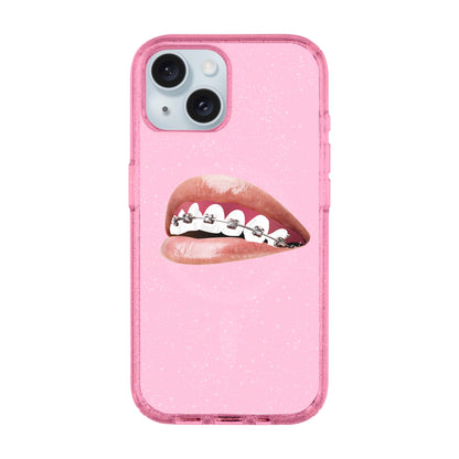 ORTHODONTIST-iPhone 14 Plus Shiny Kılıf MagSafe Özellikli