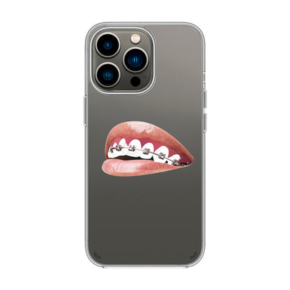 ORTHODONTIST-iPhone 12 Pro Max Solid Kılıf