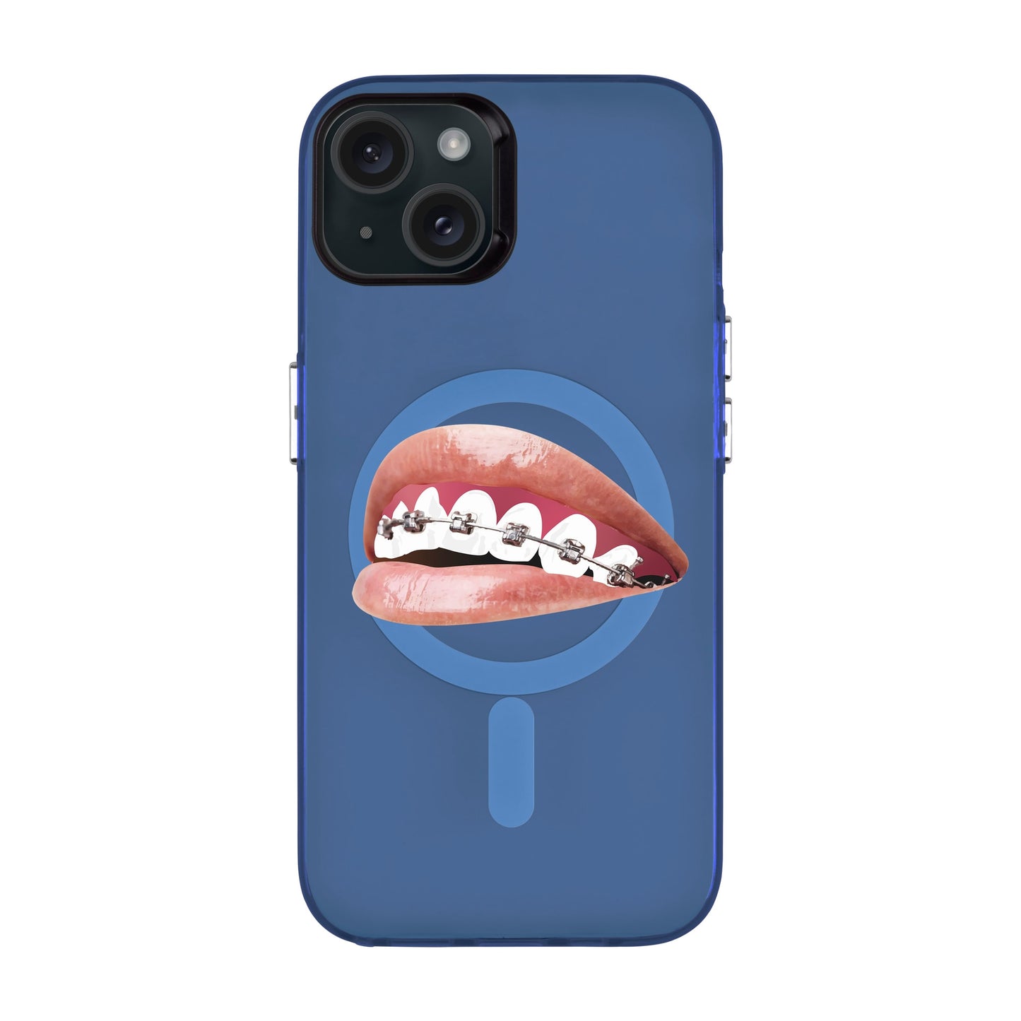 ORTHODONTIST-iPhone 15 Plus Hold Kılıf MagSafe Özellikli