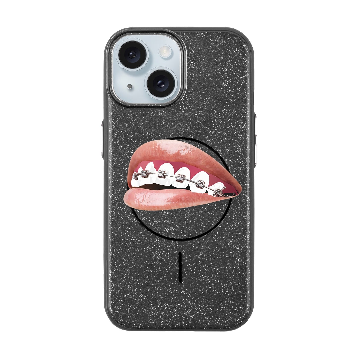 ORTHODONTIST-iPhone 15 Plus Radiant Kılıf MagSafe Özellikli