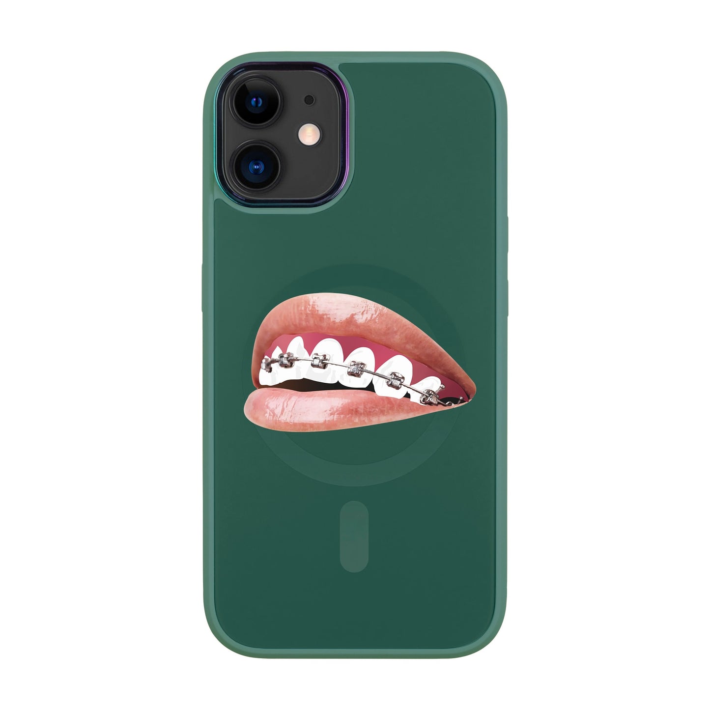 ORTHODONTİST-Vigor Kılıf MagSafe Özellikli - iPhone 11