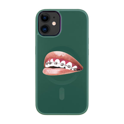 ORTHODONTİST-Vigor Kılıf MagSafe Özellikli - iPhone 11