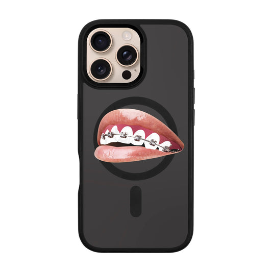 ORTHODONTIST-iPhone 16 Pro Max Rise Kılıf MagSafe Özellikli