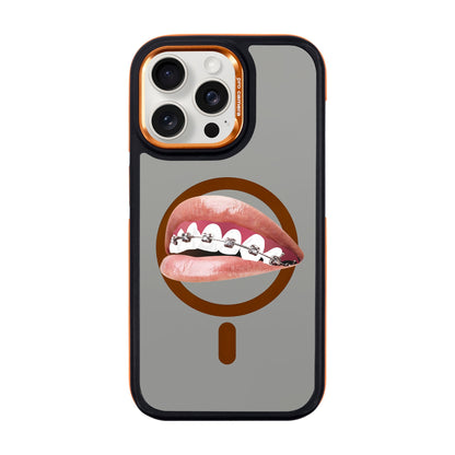 ORTHODONTIST-iPhone 15 Pro Max Dark Kılıf MagSafe Özellikli