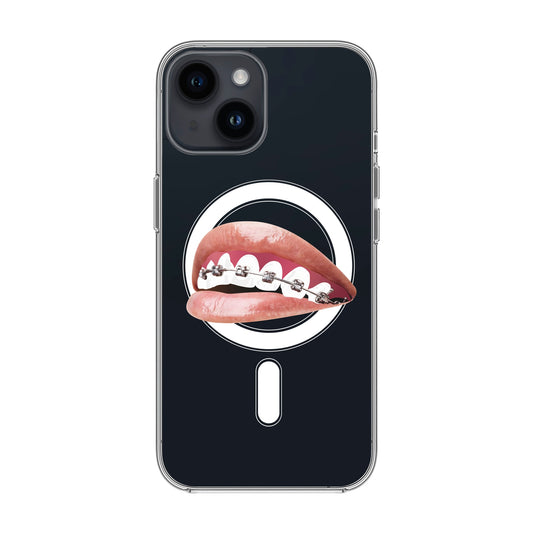 ORTHODONTIST-iPhone 13 Pro Max Solid Kılıf MagSafe Özellikli