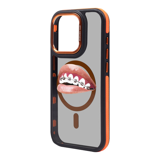 ORTHODONTIST-iPhone 15 Pro Max Dark Kılıf MagSafe Özellikli