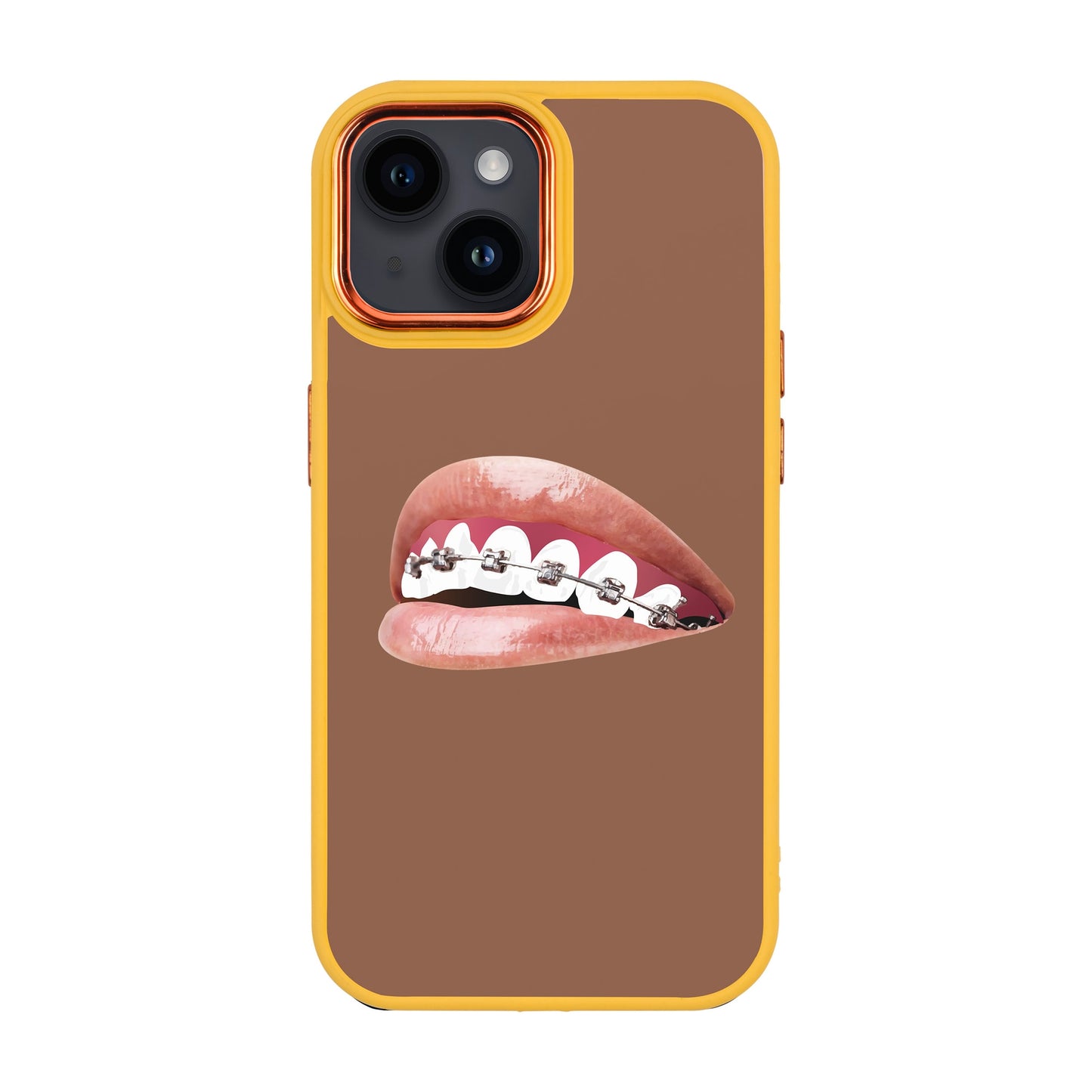 ORTHODONTIST-Proof Kılıf - iPhone 14
