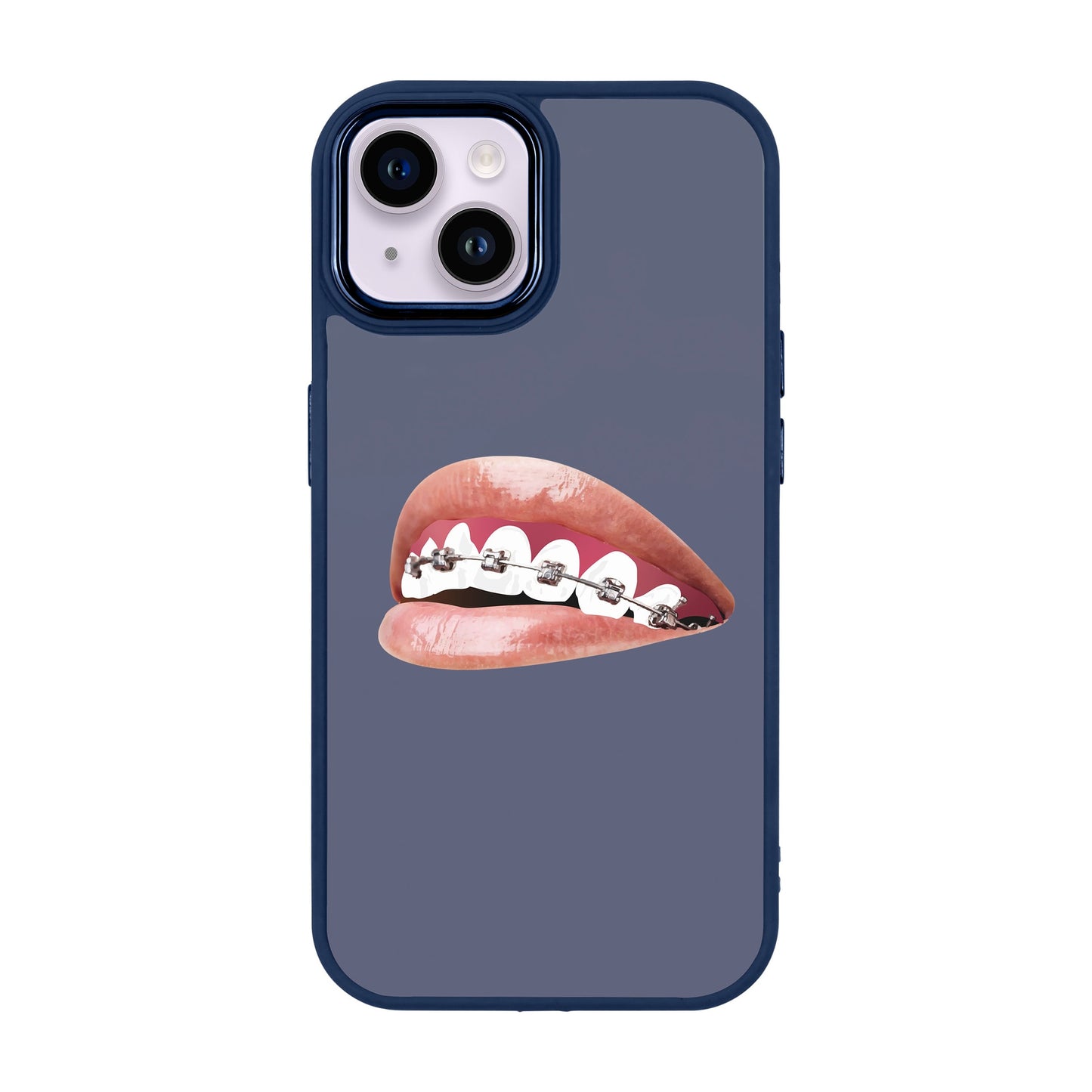 ORTHODONTIST-iPhone 14 Plus Proof Kılıf