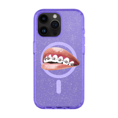 ORTHODONTIST-iPhone 14 Pro Max Shiny Kılıf MagSafe Özellikli