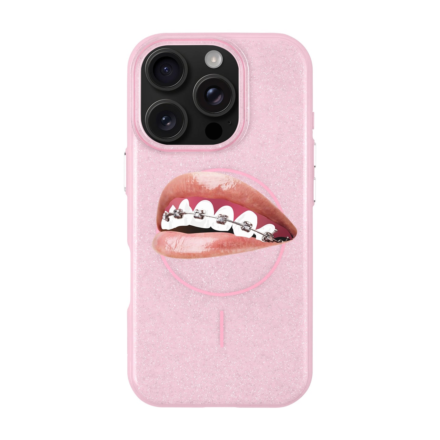 ORTHODONTIST-iPhone 16 Pro Radiant Kılıf MagSafe Özellikli
