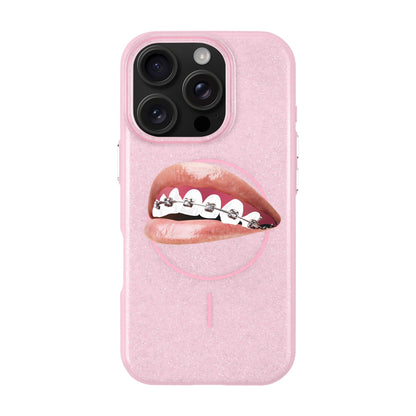 ORTHODONTIST-iPhone 16 Pro Radiant Kılıf MagSafe Özellikli