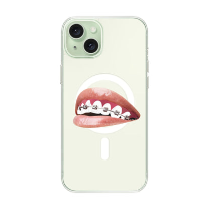 ORTHODONTIST-iPhone 15 Plus Solid Kılıf MagSafe Özellikli
