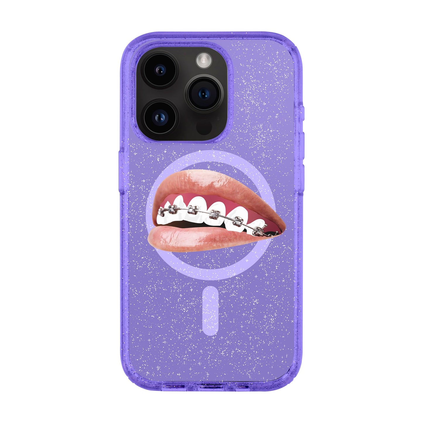 ORTHODONTIST-iPhone 14 Pro Shiny Kılıf MagSafe Özellikli