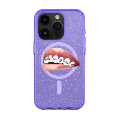 ORTHODONTIST-iPhone 14 Pro Shiny Kılıf MagSafe Özellikli