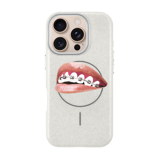 ORTHODONTIST-iPhone 16 Pro Radiant Kılıf MagSafe Özellikli