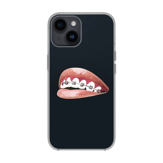 ORTHODONTIST-iPhone 14 Solid Kılıf