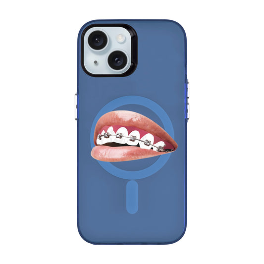 ORTHODONTIST-iPhone 15 Hold Kılıf MagSafe Özellikli