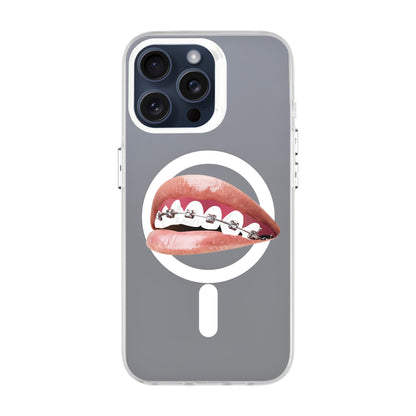 ORTHODONTIST-iPhone 13 Pro Max Hold Kılıf MagSafe Özellikli