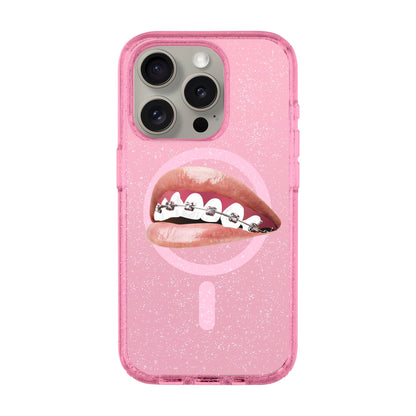 ORTHODONTIST-iPhone 15 Pro Shiny Kılıf MagSafe Özellikli