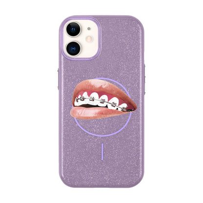 ORTHODONTIST-Radiant Kılıf MagSafe Özellikli - iPhone 11