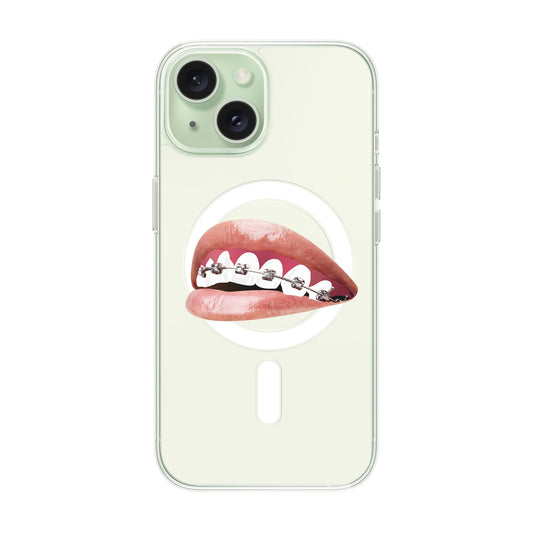 ORTHODONTIST-iPhone 15 Solid Kılıf MagSafe Özellikli