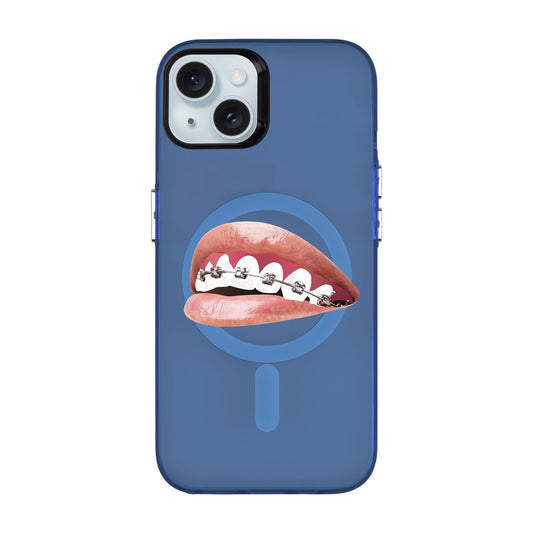 ORTHODONTIST-iPhone 15 Plus Hold Kılıf MagSafe Özellikli