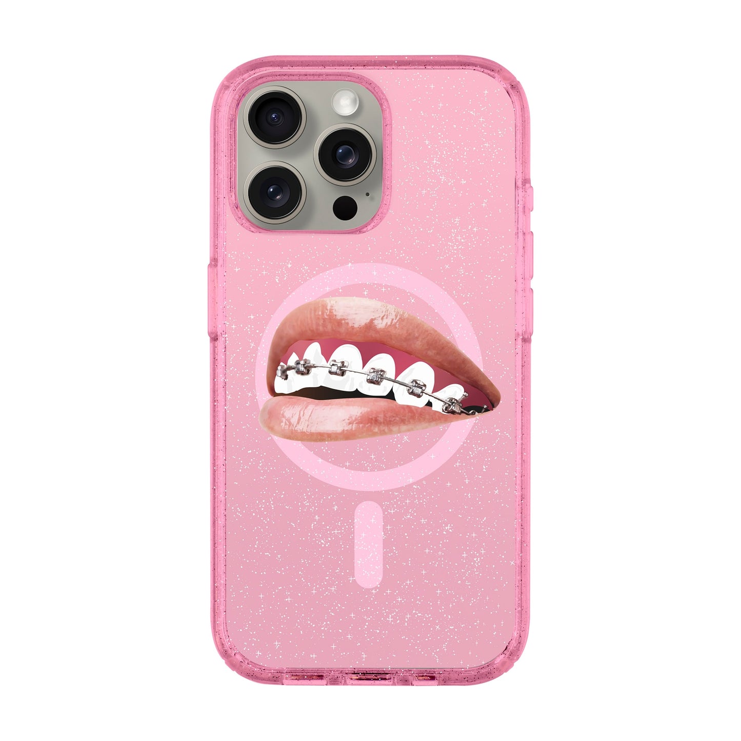 ORTHODONTIST-iPhone 15 Pro Max Shiny Kılıf MagSafe Özellikli