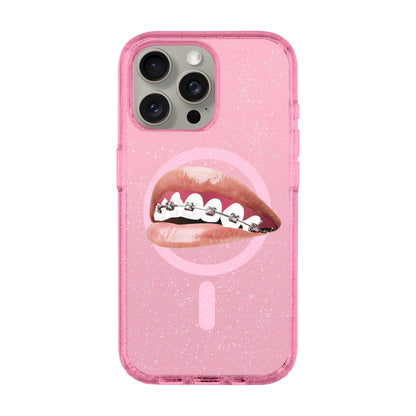 ORTHODONTIST-iPhone 15 Pro Max Shiny Kılıf MagSafe Özellikli