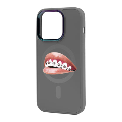 ORTHODONTİST-iPhone 14 Pro Max Vigor Kılıf MagSafe Özellikli