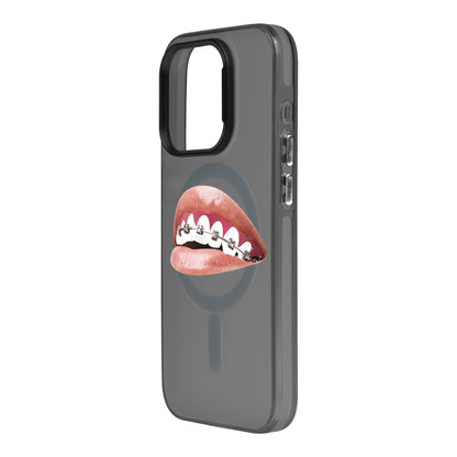 ORTHODONTIST-iPhone 15 Pro Hold Kılıf MagSafe Özellikli