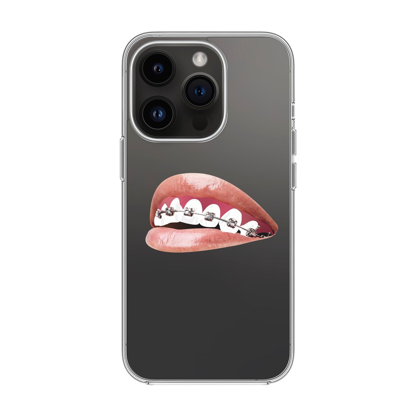 ORTHODONTIST-iPhone 14 Pro Solid Kılıf
