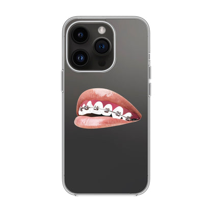 ORTHODONTIST-iPhone 14 Pro Solid Kılıf