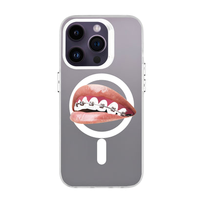 ORTHODONTIST-iPhone 14 Pro Hold Kılıf MagSafe Özellikli