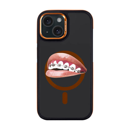 ORTHODONTIST-Dark Kılıf MagSafe Özellikli - iPhone 15