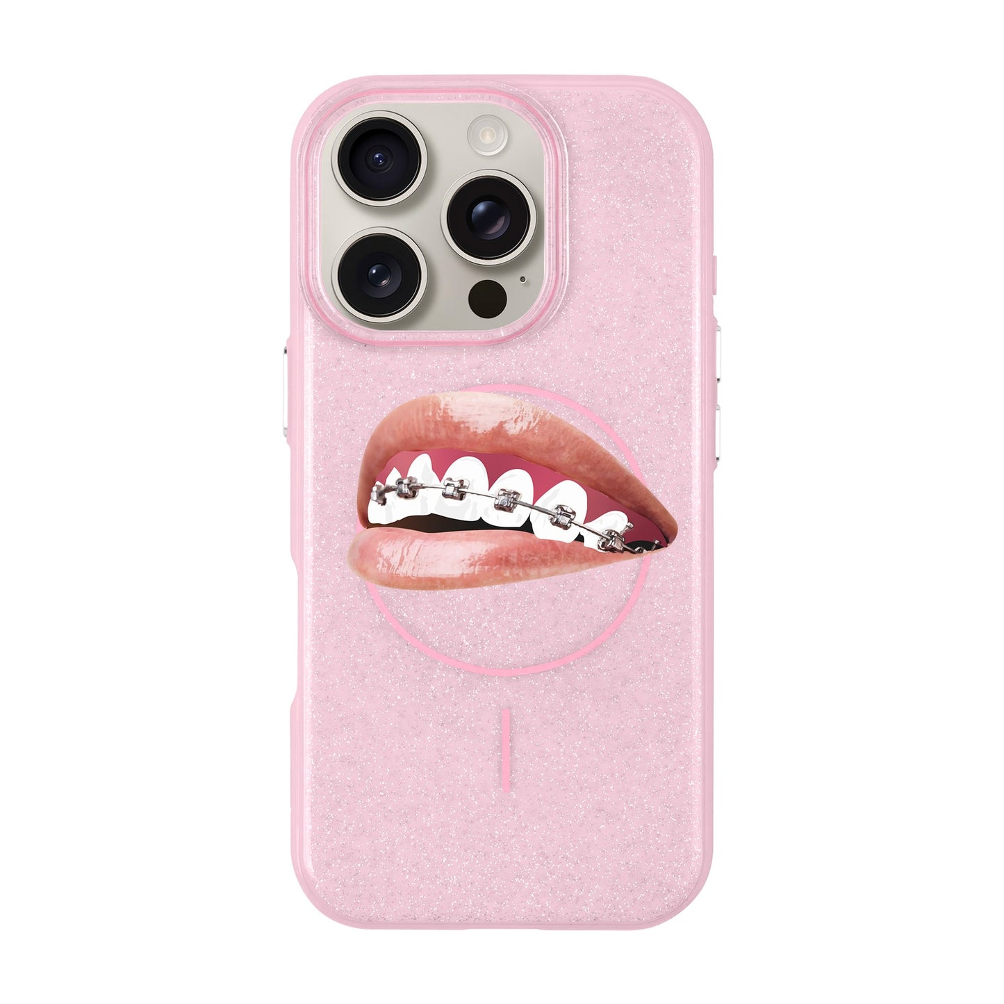 ORTHODONTIST-iPhone 16 Pro Radiant Kılıf MagSafe Özellikli