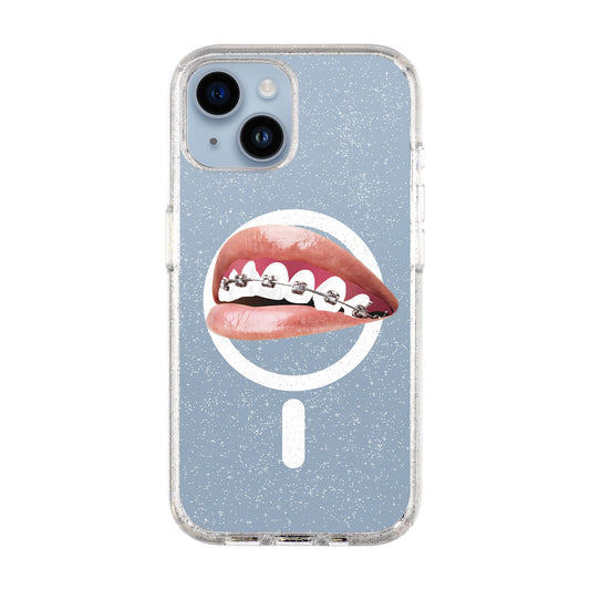 ORTHODONTIST-iPhone 14 Shiny Kılıf MagSafe Özellikli