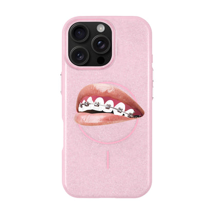 ORTHODONTIST-iPhone 16 Pro Max Radiant Kılıf MagSafe Özellikli