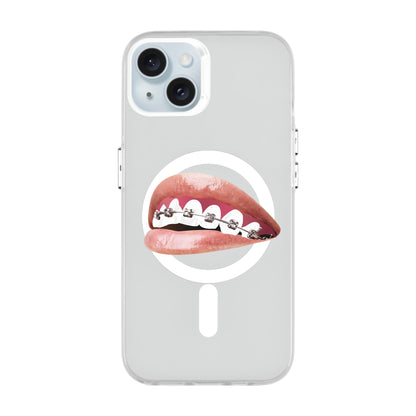 ORTHODONTIST-iPhone 15 Plus Hold Kılıf MagSafe Özellikli